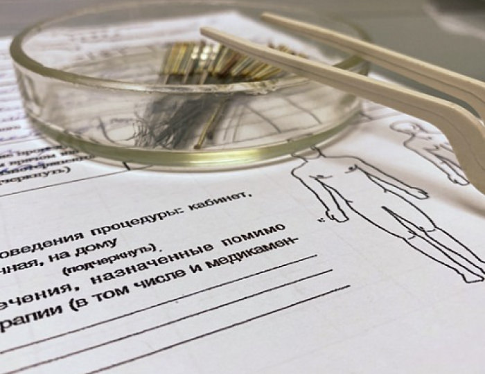 Иглорефлексотерапия - Курорт «Ерино»